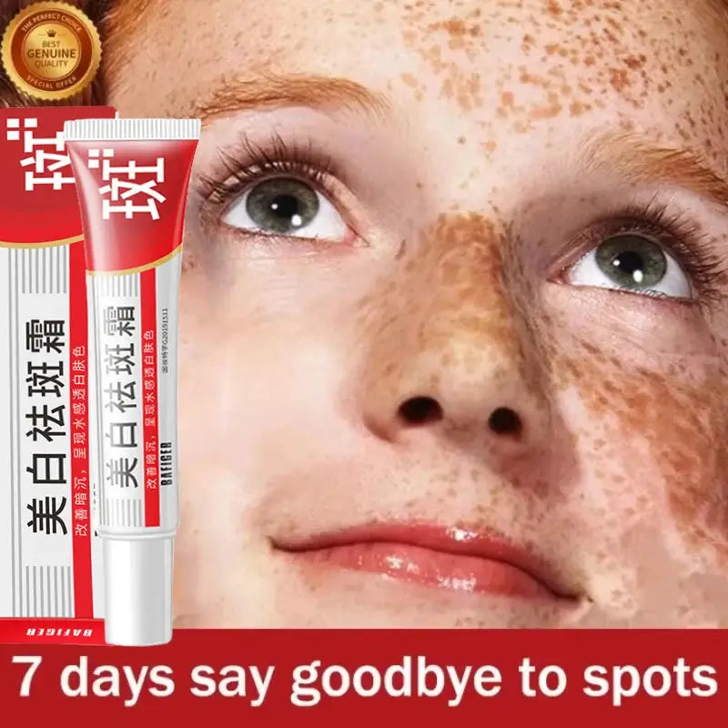 Effective Whitening Freckles Face Cream Remove Melasma Dark Spots Fade Melanin Acne Scars Anti-aging Brighten Repair Skin Care