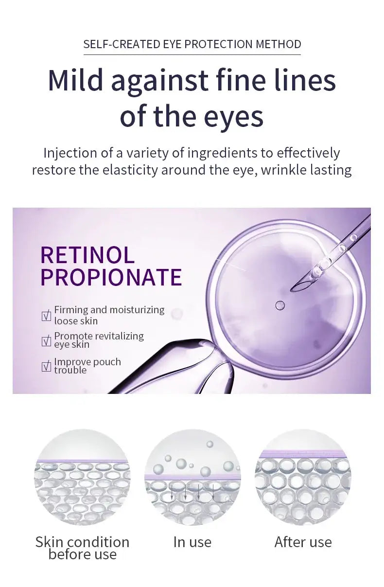 Anti Wrinkle Anti Dark Circle Eye Cream Roller Massager Moisturizing Eye Bags Anti Aging Hyaluronic Acid Eye Skin Care Products