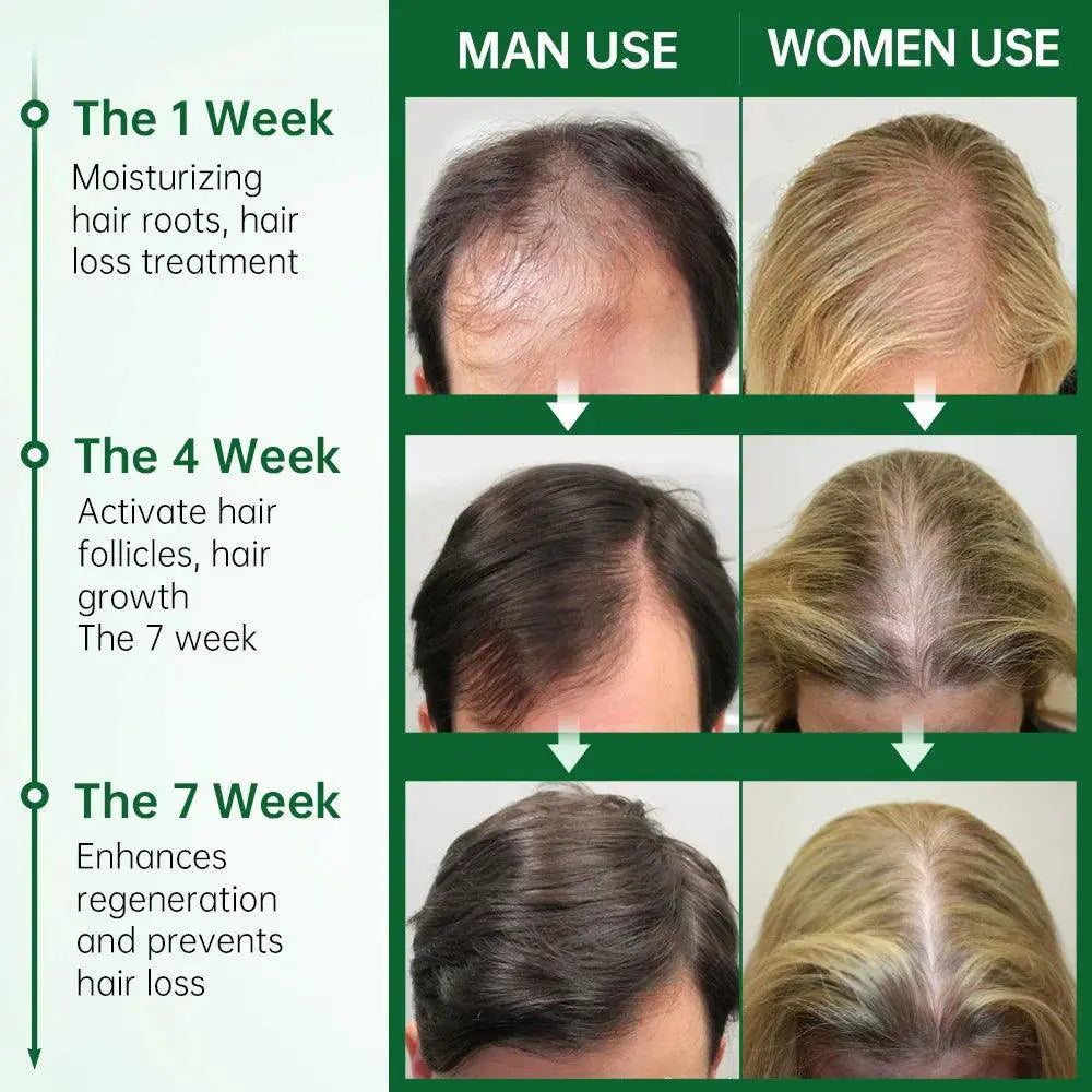 Rosemary Oil Hair Growth Elixir For Thicker Stronger Hair