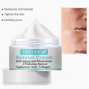 TRSTAY Whitening Freckles Cream for Melasma Dark Spots Brightening