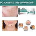 Brightening Melasma Cream for All Skin