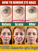 Brightening Retinol Eye Cream for Adults