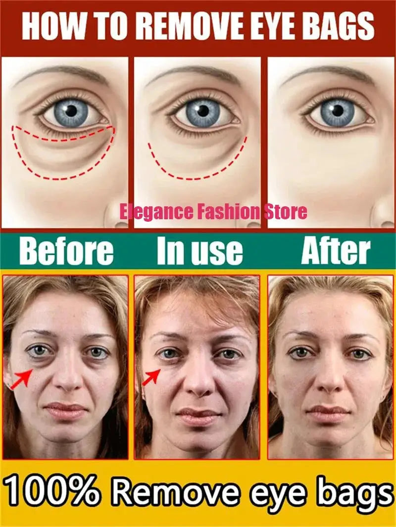 Instant Eye Bag Remove Eye Cream Anti Fat Particles Dark Circles Puffiness Fade Fine Lines Lift Brighten Korean Beauty Eye Care