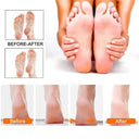 Electric Foot File - Rechargeable Callus Remover