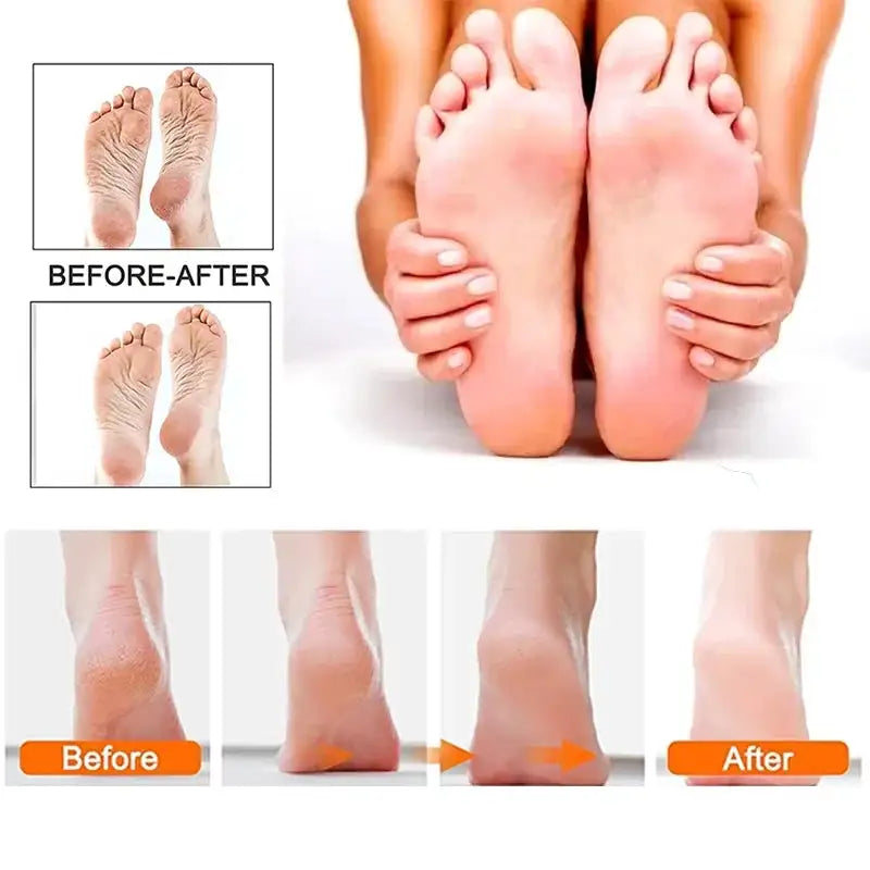 Rechargeable Electric Foot File 1+10 Set Callus Remover Machine Pedicure Device Foot Care Tools For Heels Remove Dead Skin Black
