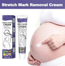 Stretch Mark Removal Cream for New Moms