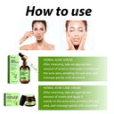 Hoygi Acne Cream for Oily Skin Relief