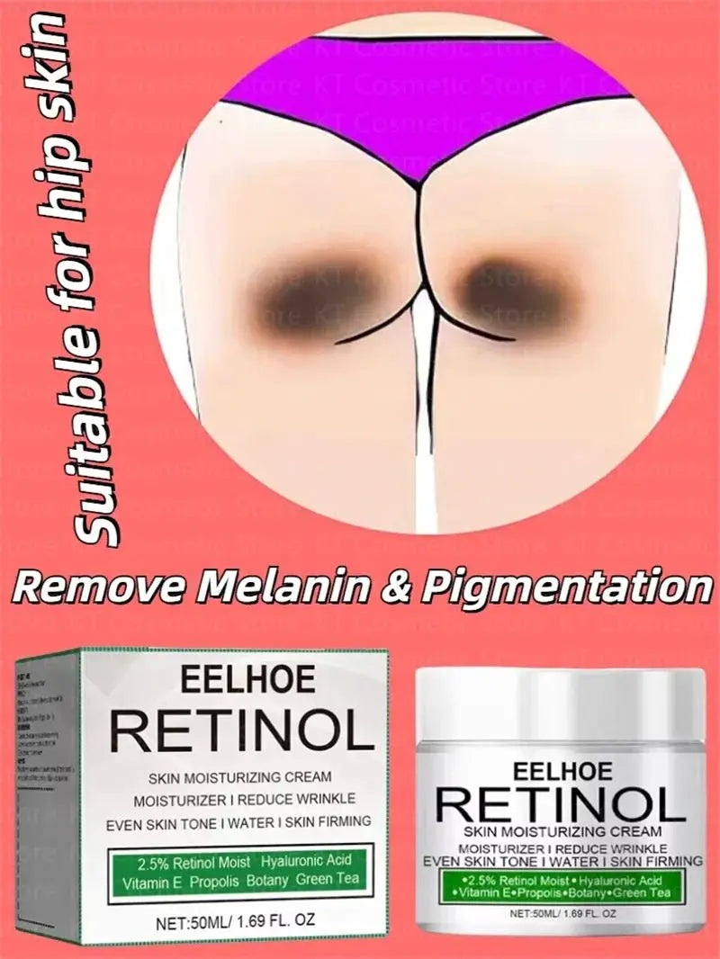 Body Whitening Cream Dark Skin Armpit Lightening Intimate Areas Underarm Bleaching Private Parts Whiten Cream Body Lotion Beauty