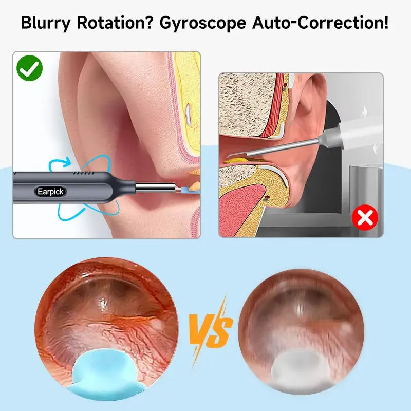Type-C Smart Visual Ear Cleaner