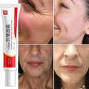 Anti Aging Cream For Mature Skin Lifts