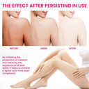 Whitening Body Cream For Dark Spots
