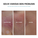 Calming Hydration Cream for Redness