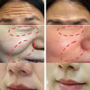 Anti-Wrinkle Balm For On-The-Go