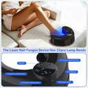 Wireless Nail Fungus Cleaning Device for Toenails & Fingernails
