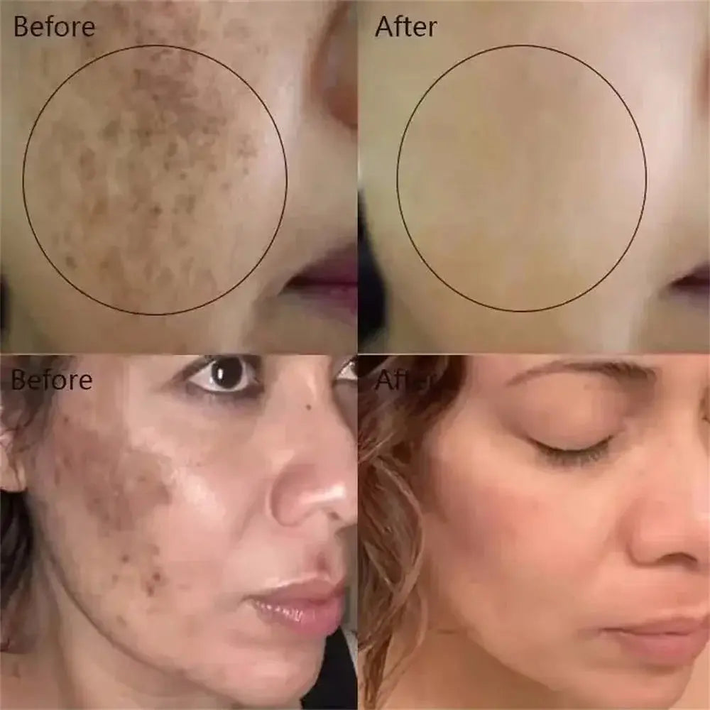 Hydrating Whitening Cream for Dark Spots — product view 12
