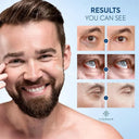 Eye Cream for Men Reduces Puffiness