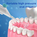 Portable Water Flosser - High Pressure Deep Clean