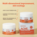 Oil Control Acne Cream for Clear Skin