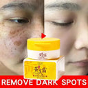 Whitening Freckle Face Cream for Melasma