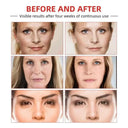 Anti-Aging Retinol Cream for Adults
