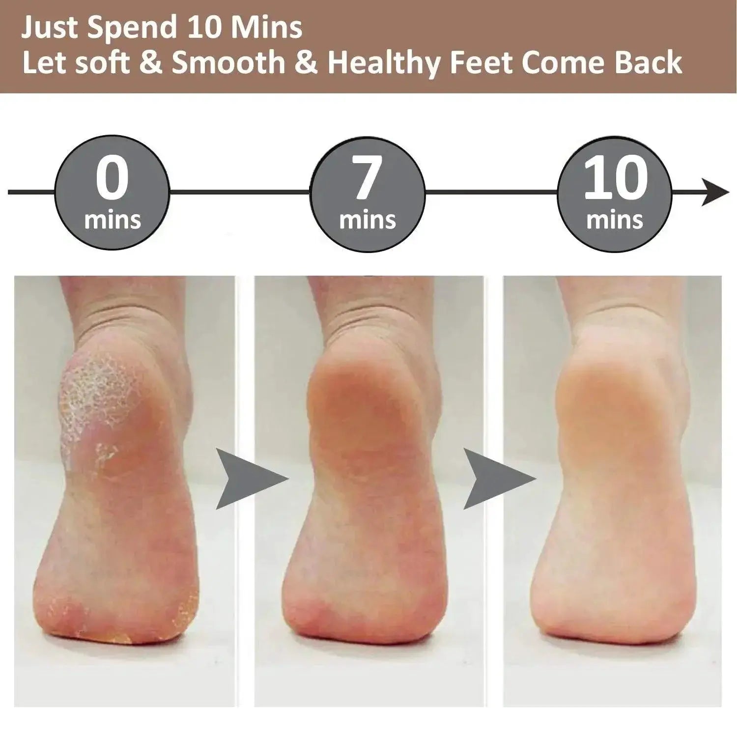 Electric Callus Remover Portable Rechargeable Foot File