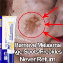 LAIKOU Whitening Spot Removing Cream For Dark Spots Melasma Brightening
