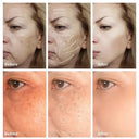 Freckle Cream For Brighter Skin