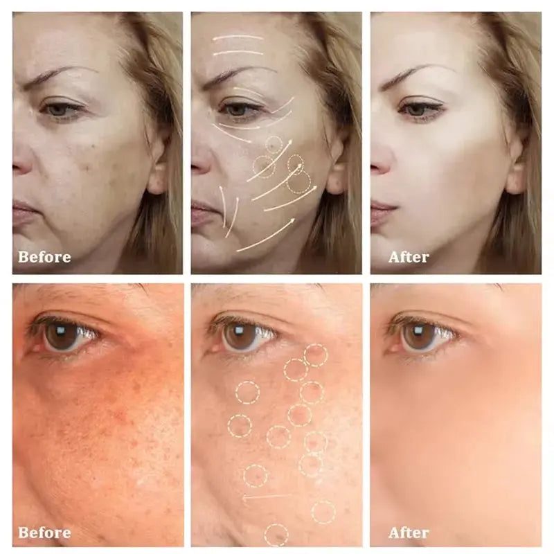Astragalus Whitening Freckles Face Cream Remove Dark Spots Melasma Lighten Melanin Acne Scars Anti-aging Brighten Skin Care 55g