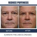 Eye Cream for Men Reduces Puffiness