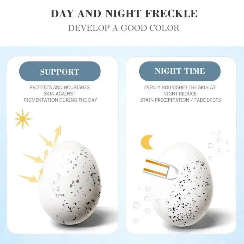 Whitening Freckles Cream Remove Melasma Dark Spots Lighten Melanin Melasma Remover Moisturizing Brighten Face Skin Care TRSTAY