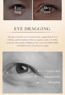 Sadoer Eye Cream For Dark Circles Glow