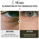 Firming Eye Roll On For Puffiness Now