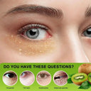 Eelhoe Fat Granules Remover Eye Cream Unisex Whitening 20ml