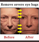 Eelhoe Eye Cream Anti Puffiness Dark Circles Firming Moisturizing 15ml