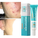 PWYUMAN Acne Cream for Acne Prone Skin