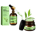 Hoygi Acne Cream for Oily Skin Relief