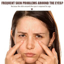 Bee Venom Eye Cream for Puffiness Relief