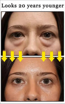Eelhoe Eye Cream Anti Puffiness Dark Circles Firming Moisturizing 15ml