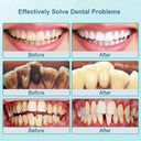 Ultrasonic Stain Remover for Clean Teeth