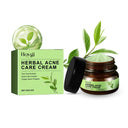Hoygi Acne Cream for Oily Skin Relief