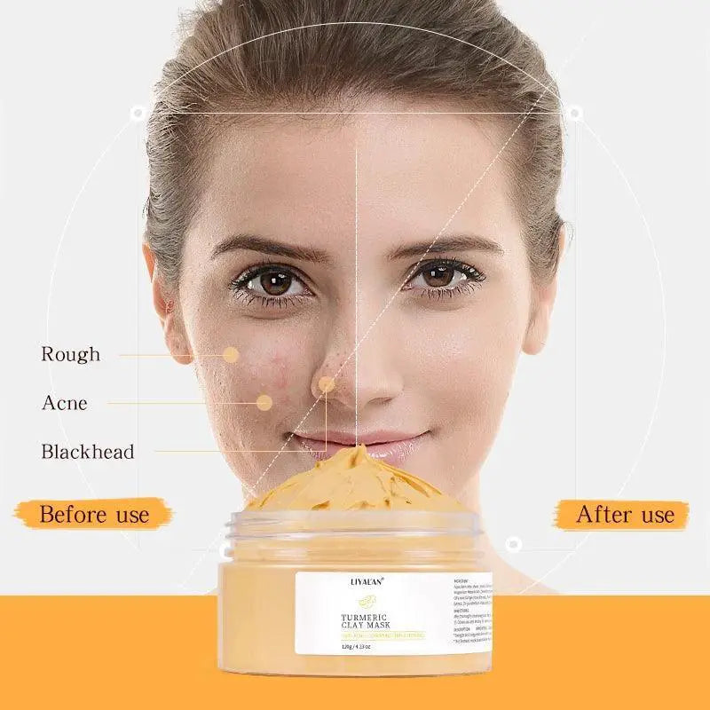 Turmeric Clay Mask for Acne and Blackhead Removal Treatment