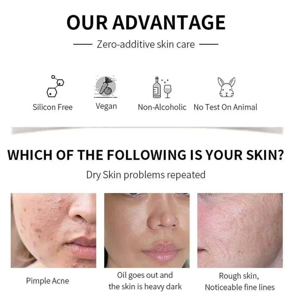New Face Peeling Solution AHA 30 Percent BHA 2 Percent Serum