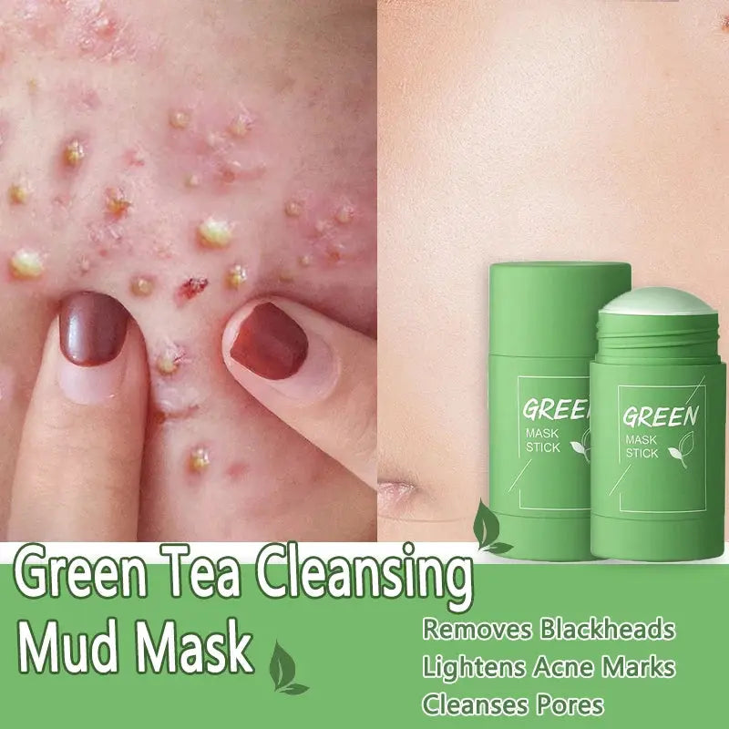 Original Facial Remove Blackhead Green Tea Solid Mask Treat Acne Blemish Black Dots Clean Stick Cream Shrink Pores Skin Care