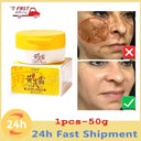 Whitening Freckle Face Cream for Melasma