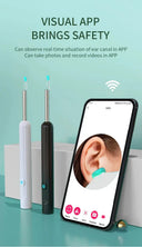 Ear Cleaner with Camera for Smart Living