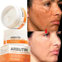 Freckle Cream For Brighter Skin