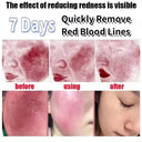 Facial Redness Repair Cream For Sensitive Skin Rosacea Hydrating Day Night