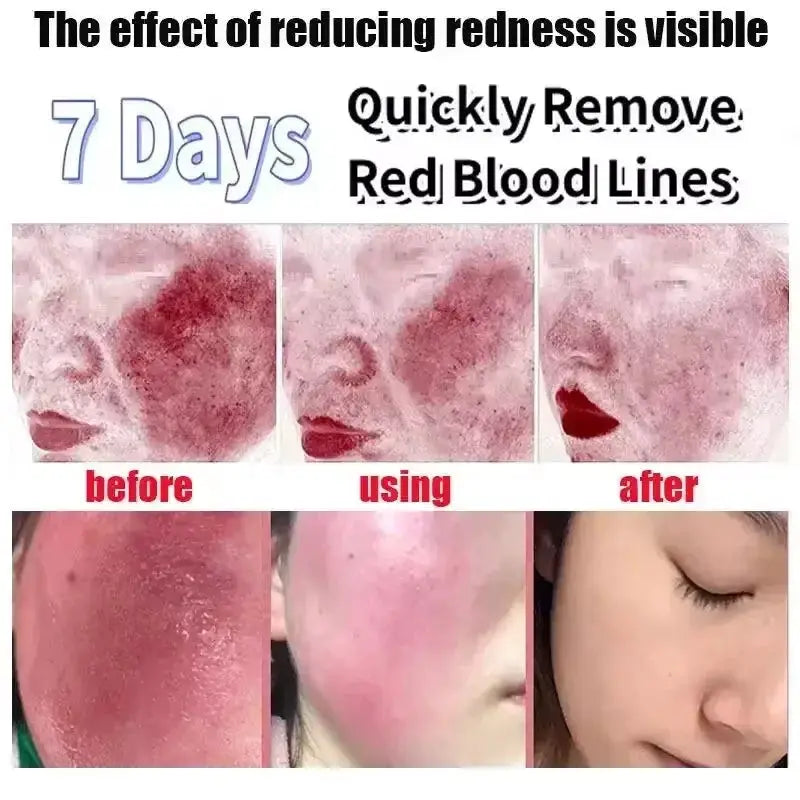Facial Redness Repair Cream Improve Sensitive Skin Dryness Hydrating Sooth Lotion Removal Rosacea Day Night Korean Cosmetics