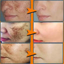 Face Cream for All Skin Brightens Tone
