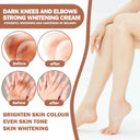 Dark Knuckles Brightening Cream For Elbows And Knees Body Whitening Serum